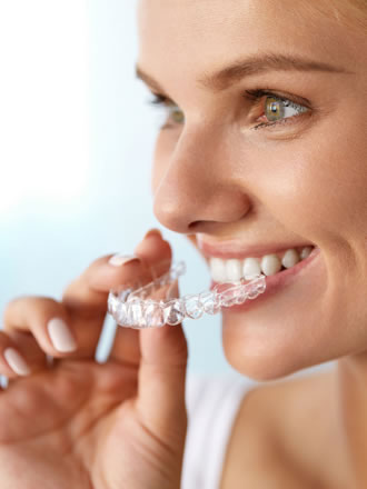 clear aligners